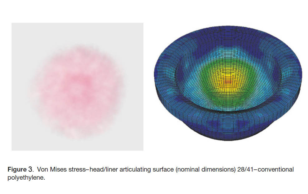 Fuji Prescale Tactile Pressure Mapping For Improved Artificial Hips Design: Tactile pressure mapping on liner fuji prescale and FEA